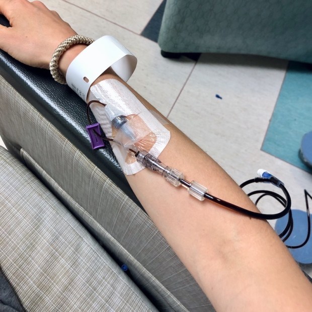 IV iron infusion port