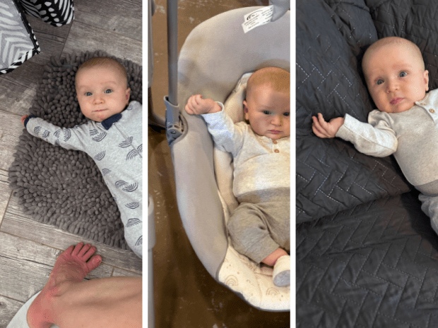 Baby's hand and arm in weird position after shoulder dystocia