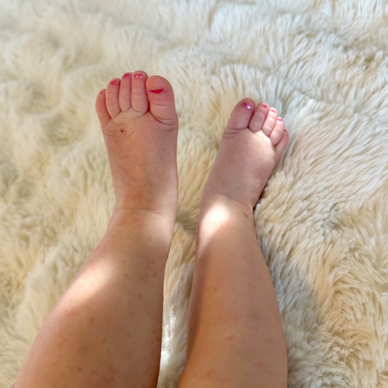Baby's painted toenails
