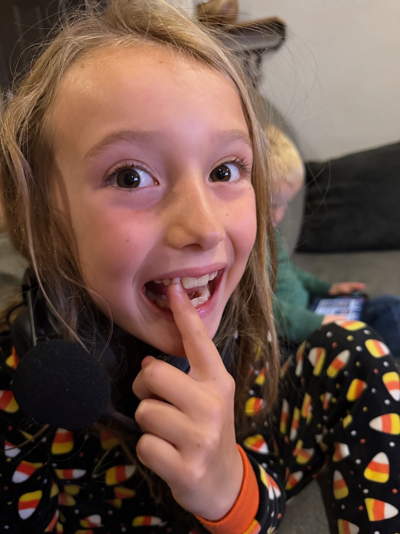 Girl with loose tooth